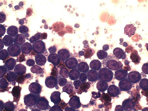 Big Cell Lymphoma In Cats