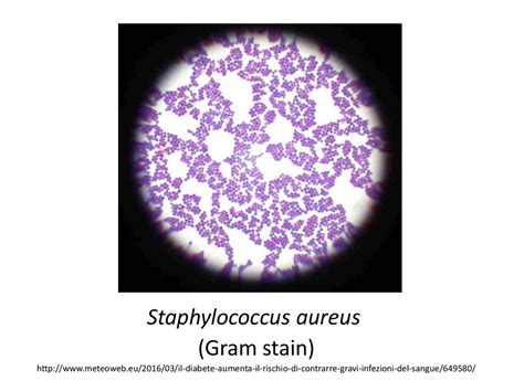 Gram Stain Streptococci