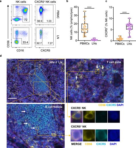 Implications Of The Accumulation Of Cxcr5 Nk Cells In Lymph Nodes Of
