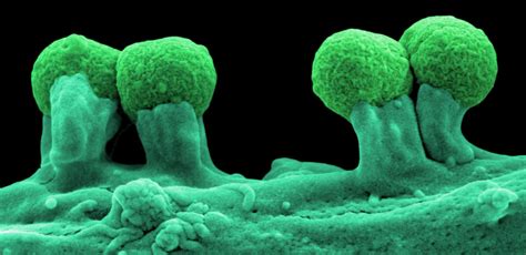 Coli are harmless or cause relatively brief diarrhea. 'Hoe het kapitalisme onze relatie met bacteriën om zeep ...