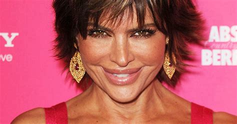 Lisa Rinna Lip Reduction Surgery Why Did She Do It Cbs News