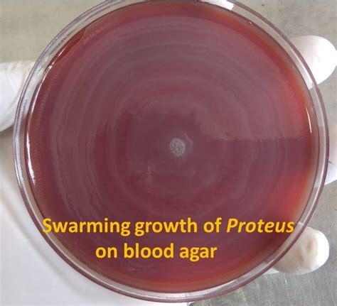Swarming Growth Of Proteus On Blood Agar Description Of Swarming