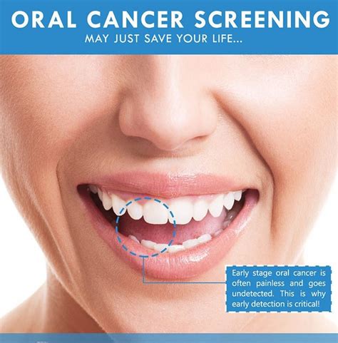 Free Oral Cancer Screenings For New Patients Throughout April 2017 At