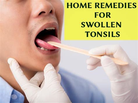 7 Most Effective Home Remedies For Swollen Tonsils