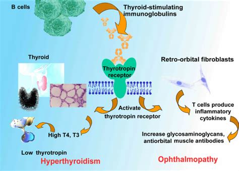 Graves Disease Ctla4 Home