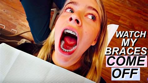 Marla Gets Her Braces Off Youtube