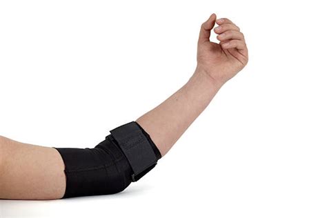Elbow Dislocation Stock Photos Pictures And Royalty Free Images Istock