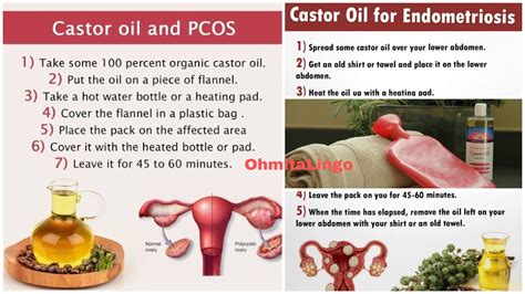 How To Make Uterus Strong Naturally Castor Oil Pack For Colduterus