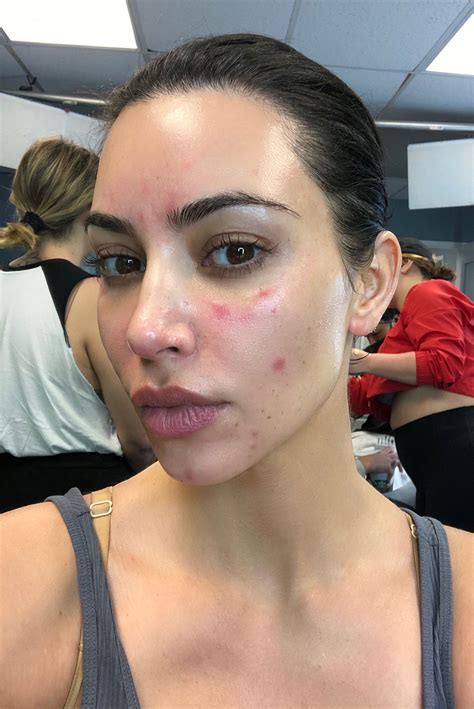 All The Times Kim Kardashian Revealed Her Real Skin As Fans Slam Her