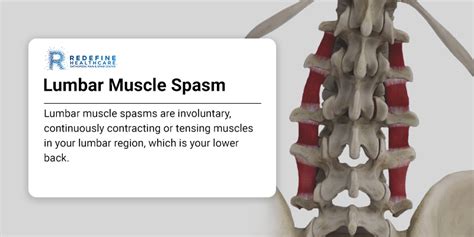 Lumbar Muscle Spasm Symptoms Causes And Treatment