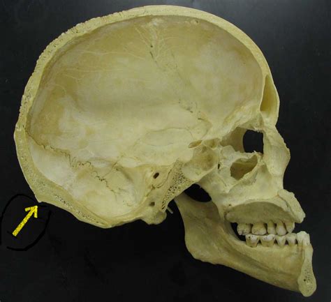 The skull is a bony structure that supports the face and forms a protective cavity for the brain. Inion - Wikipedia