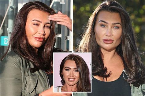Lauren Goodger Sparks Cosmetic Surgery Rumours After Showing Off