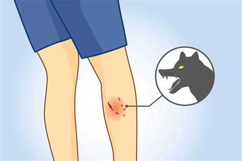 What You Should Do After A Dog Bite In Houston D Miller And Associates