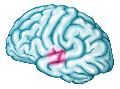 Wernicke S Area Location Function And Wernicke S Aphasia