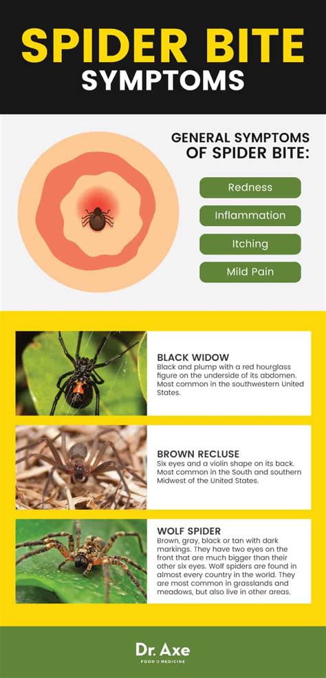 The actual bite looks a lot like any other spider bite. Spider Bite! Symptoms + 6 Easy Natural Treatments - Get ...