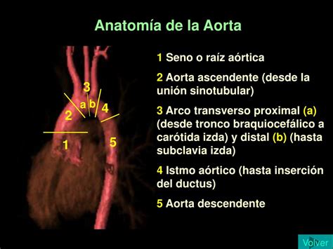 Ppt Coartaci N A Rtica Estudio Morfol Gico Y Funcional Con