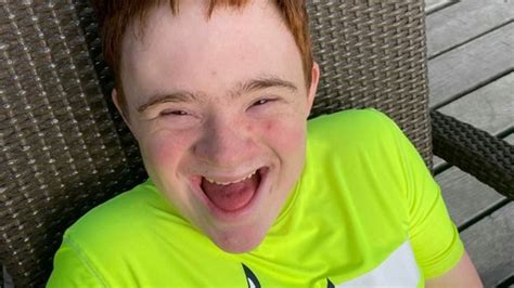 Downs Syndrome In All Honesty We Were Offered 15 Terminations Bbc News