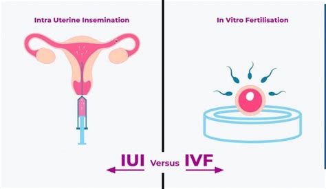 intrauterine insemination iui vs in vitro fertilization ivf kjk hospital trivandrum