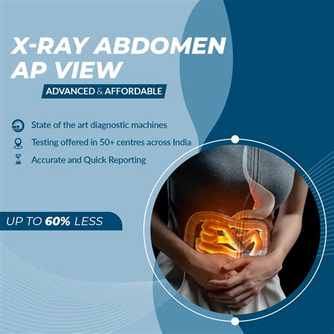 X Ray Abdomen Ap View Aarthi Scans And Labs