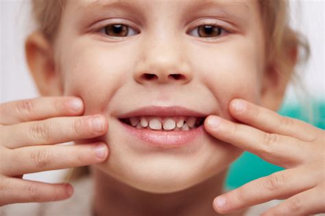 Oral Health Problems Children Face Today Hardy Pediatric Dentistry