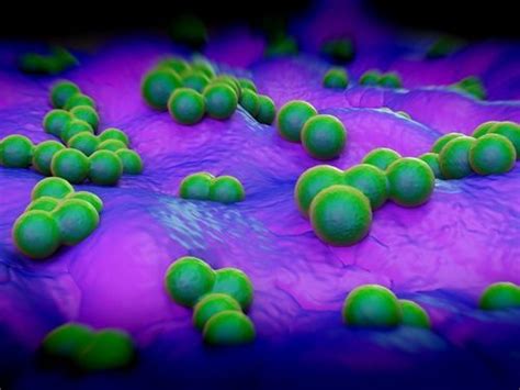Mrsa Rates Dropped 87 In Va Hospital Icus Hospital Acquired