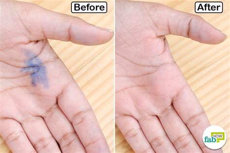 10 Simple Ways To Remove Ink Stains From Hands Fab How