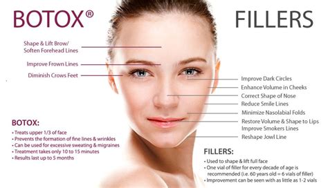 Infographic How Botox Botox Fillers Botox Cosmetic Injectables