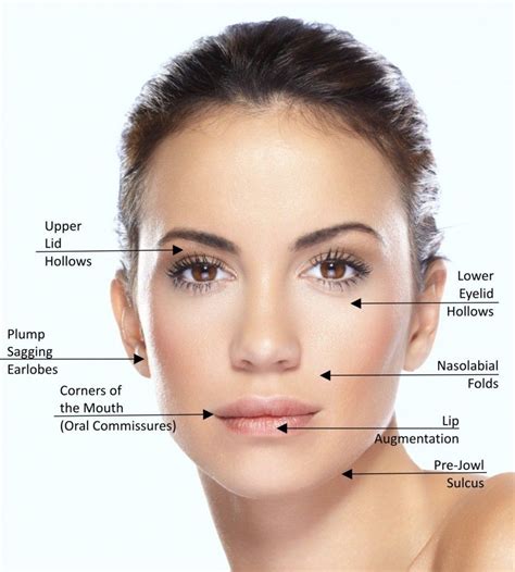 Dermal Fillers Are Not Just For Nasolabial Folds And Lips Check Out