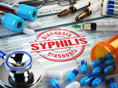 Latent Syphilis Early And Late Latent Syphilis