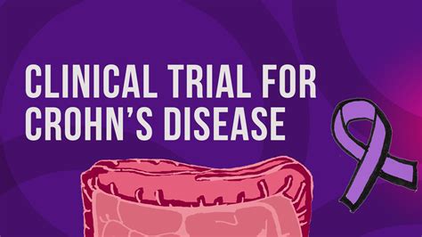 Clinical Trial For Crohn S Disease Om Research
