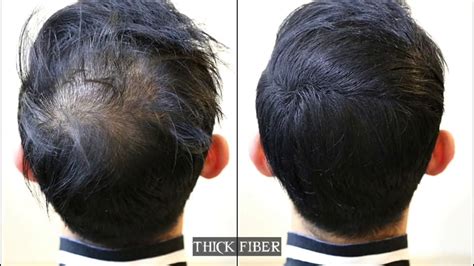 Bald Spot Hair Spray Hair Loss Concealer Spray Glh Dark Brown