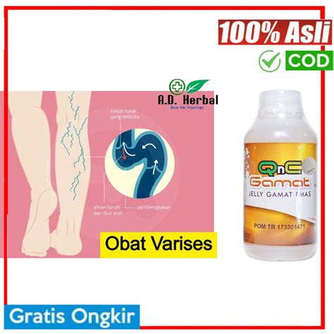 Maybe you would like to learn more about one of these? Obat Varises di kaki atau betis paha Urat Bercabang keluar ...