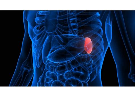 Enlarged Spleen Splenomegaly Symptoms Causes And Treatment Options