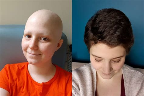 My Hair Growth After Chemo Griffblog Travel And Book Blog