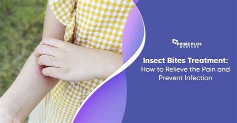 Insect Bite Treatment Everything You Need To Know Prime Plus Medical