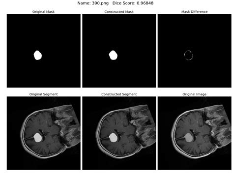 Brain Tumor Segmentation