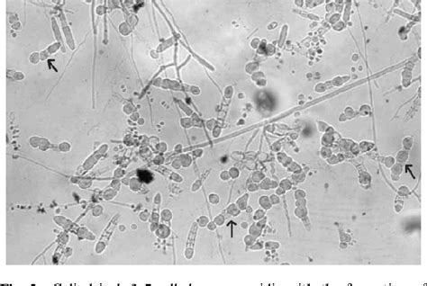 Figure From Tinea Corporis Due To Trichophyton Simii A First Case From Iran Semantic Scholar