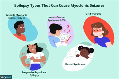 Myoclonic Seizures Triggers Symptoms And Treatment