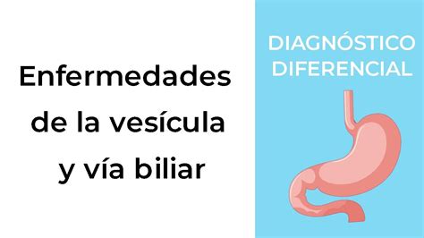 Diagn Stico Diferencial Enfermedades De La Ves Cula Y V A Biliar Youtube