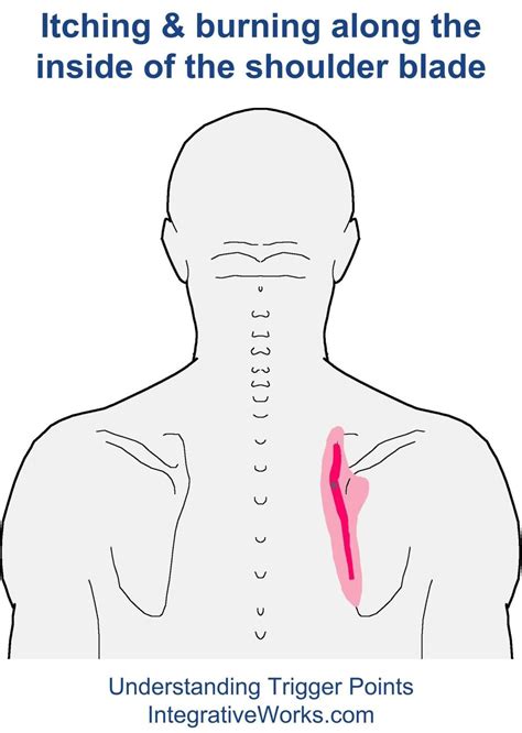 Can Gas Cause Pain Between Shoulder Blades