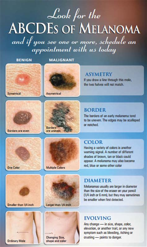 Skin Cancer Jupiter Dermatology And Hair Restoration