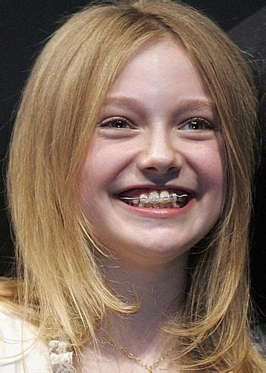 Celebrities Who Have Had Orthodontic Treatment Orthodontist Whitby Braces Whitby