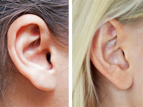 Attached And Detached Earlobes The Curious Genetics Behind Your Ears