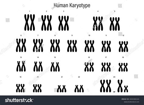 Human Karyotype Autosome Sex Chromosome Male Stock Vector Royalty Free 2222181121 Shutterstock