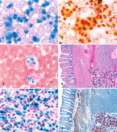 Rectal Mass Aspirate Dog The Neoplastic Cells Have Plasmacytoid