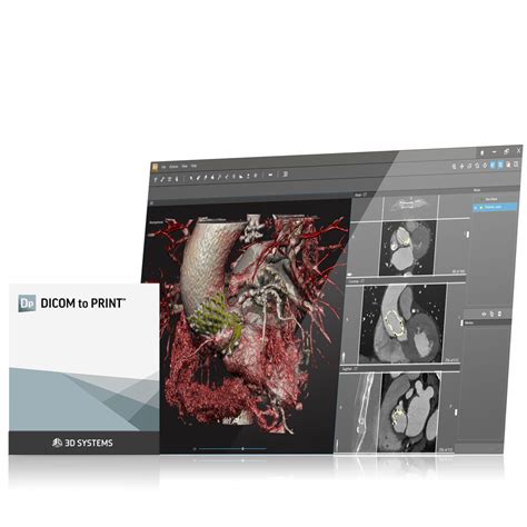 dicom to print using ct and mri data intelligently or3d