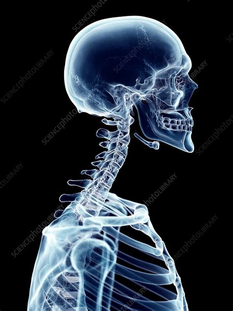 Human Cervical Spine Stock Image F0163259 Science Photo Library