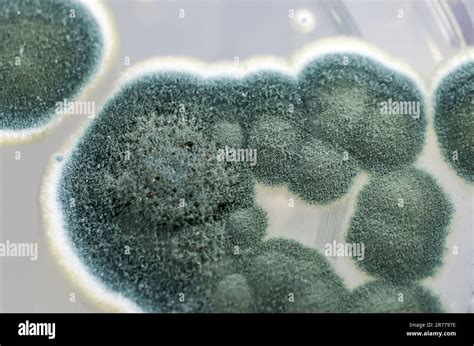 Colonies Of Penicillium Fungi Grown On Sabouraud Dextrose Agar Sda