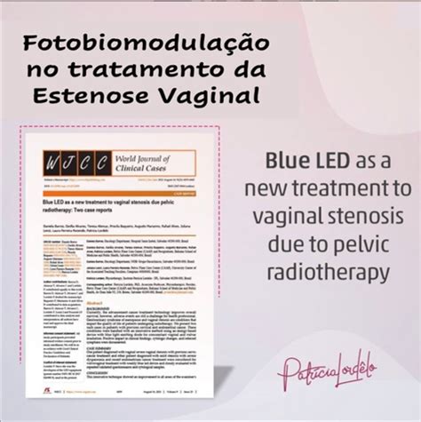 Artigo sobre Fotobiomodulação na Estenose Vaginal IPL Instituto