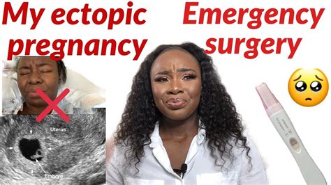 My Ectopic Pregnancy Story Emergency Surgerymisscarriage Youtube